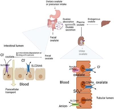 Oxalate as a potent promoter of kidney stone formation